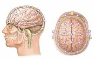 Эхоэнцефалография (эхо-эг) — ультразвуковой метод исследования головного мозга